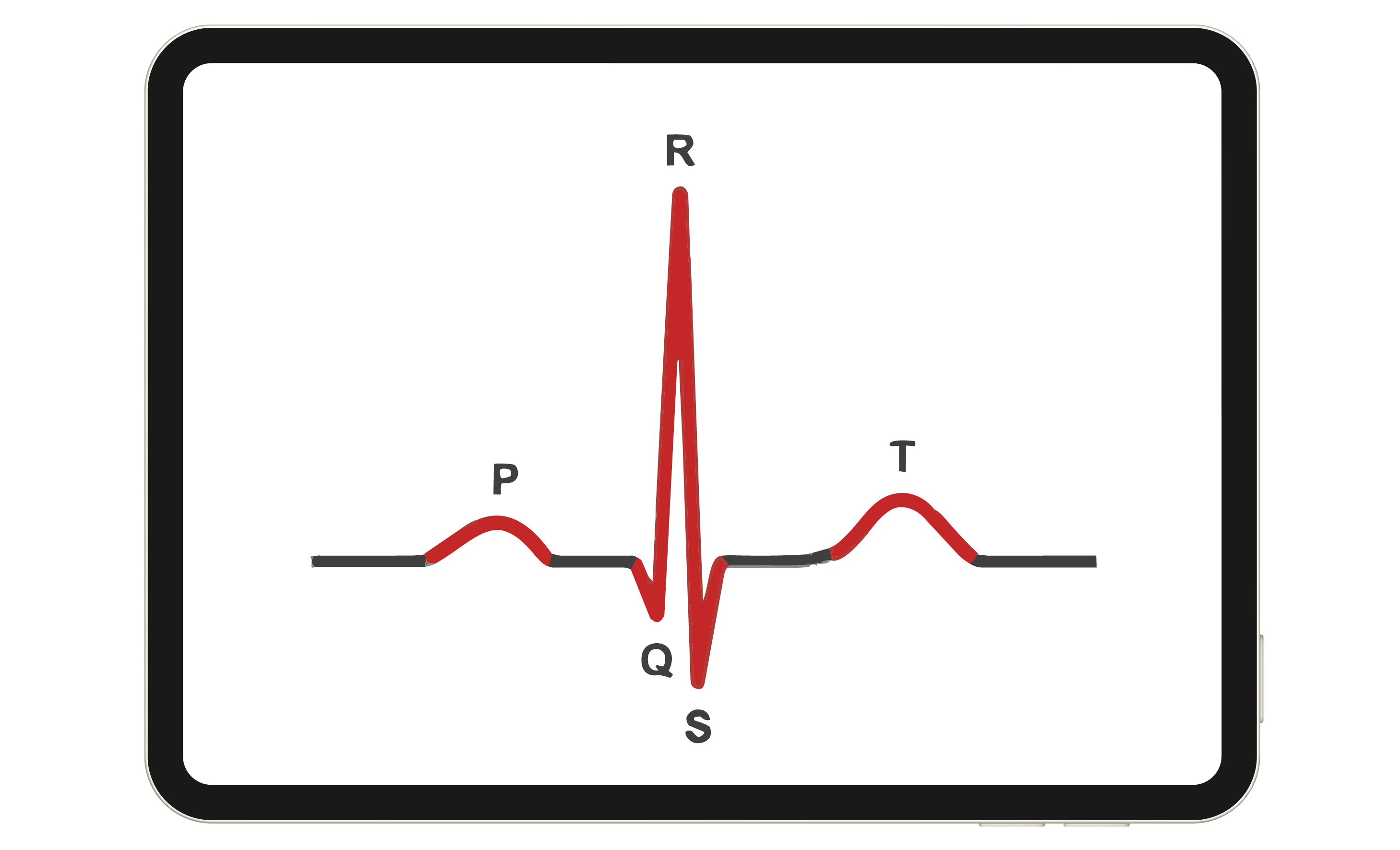 PLS courses/ArrhythmiaRecognition_Overview_Image2